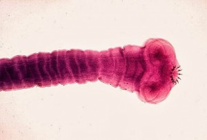 Tapeworm