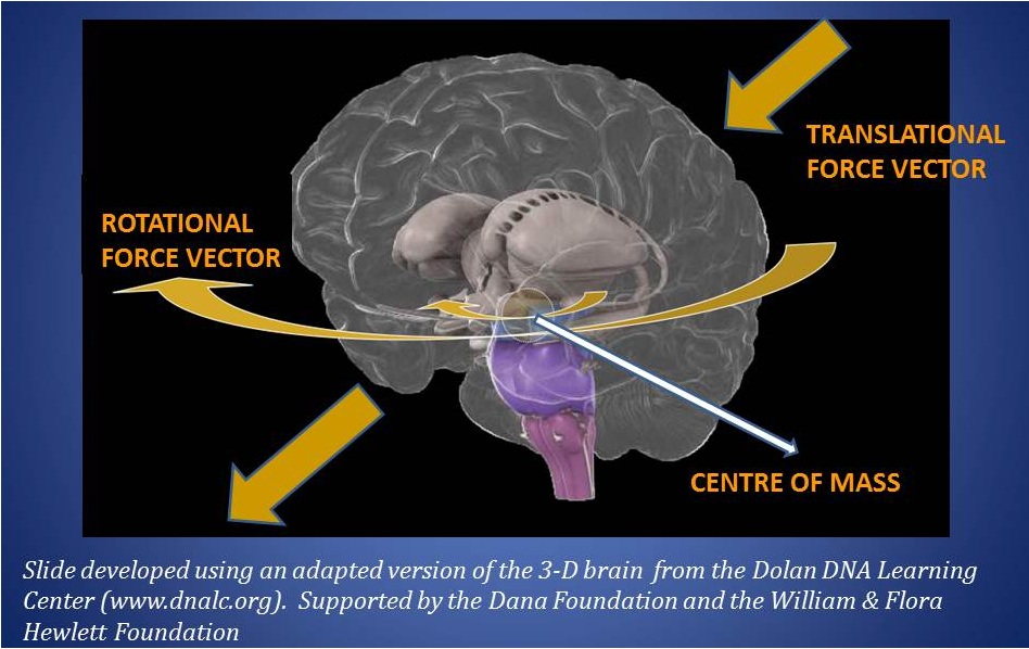 Inertial Forces in TBI